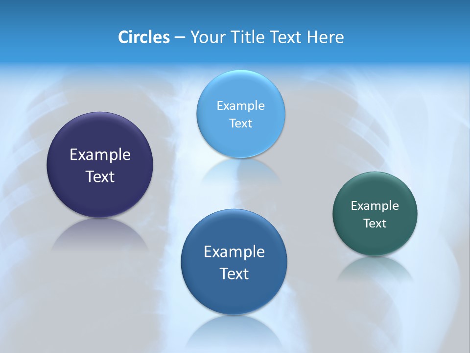 A Radiograph Of Human Body Is In Black And White Tones PowerPoint Template