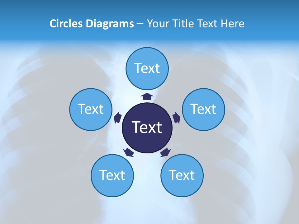 A Radiograph Of Human Body Is In Black And White Tones PowerPoint Template