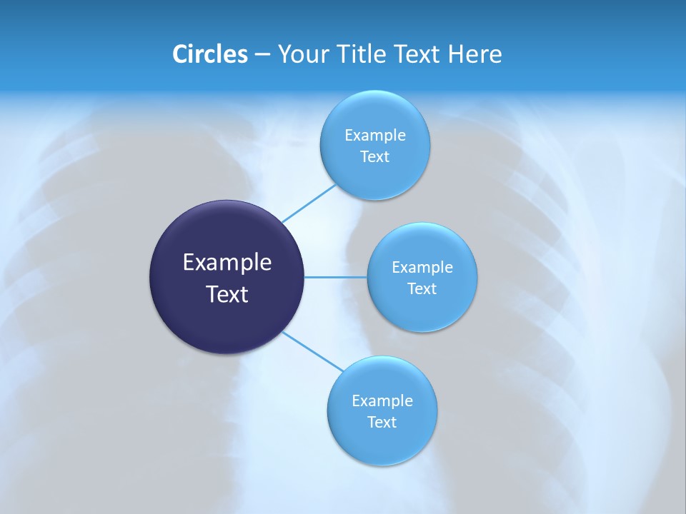 A Radiograph Of Human Body Is In Black And White Tones PowerPoint Template