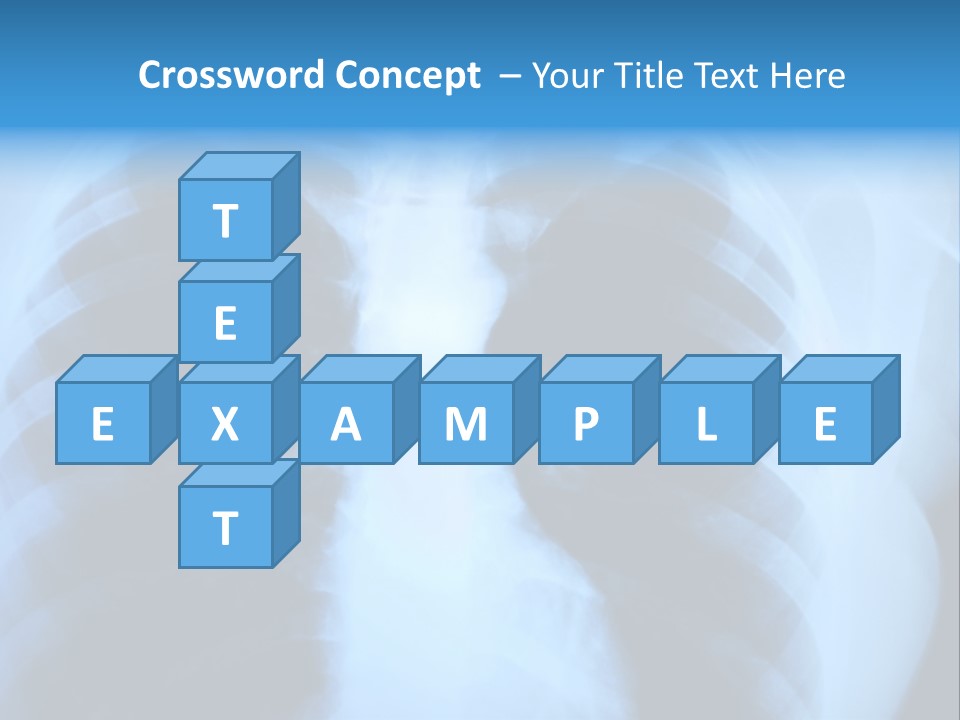 A Radiograph Of Human Body Is In Black And White Tones PowerPoint Template