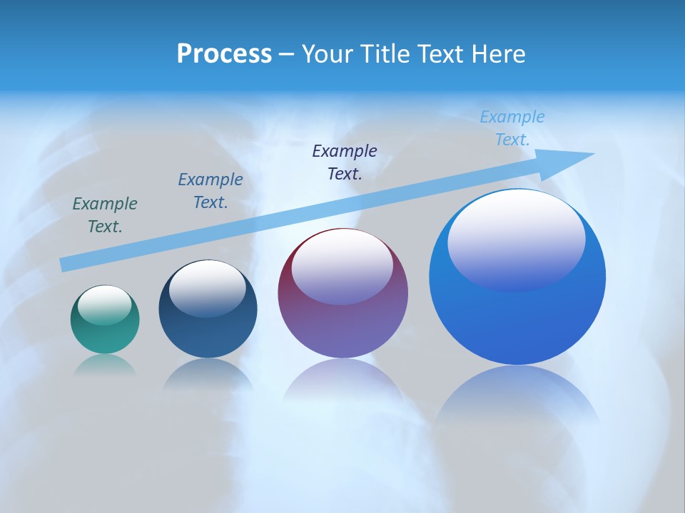 A Radiograph Of Human Body Is In Black And White Tones PowerPoint Template