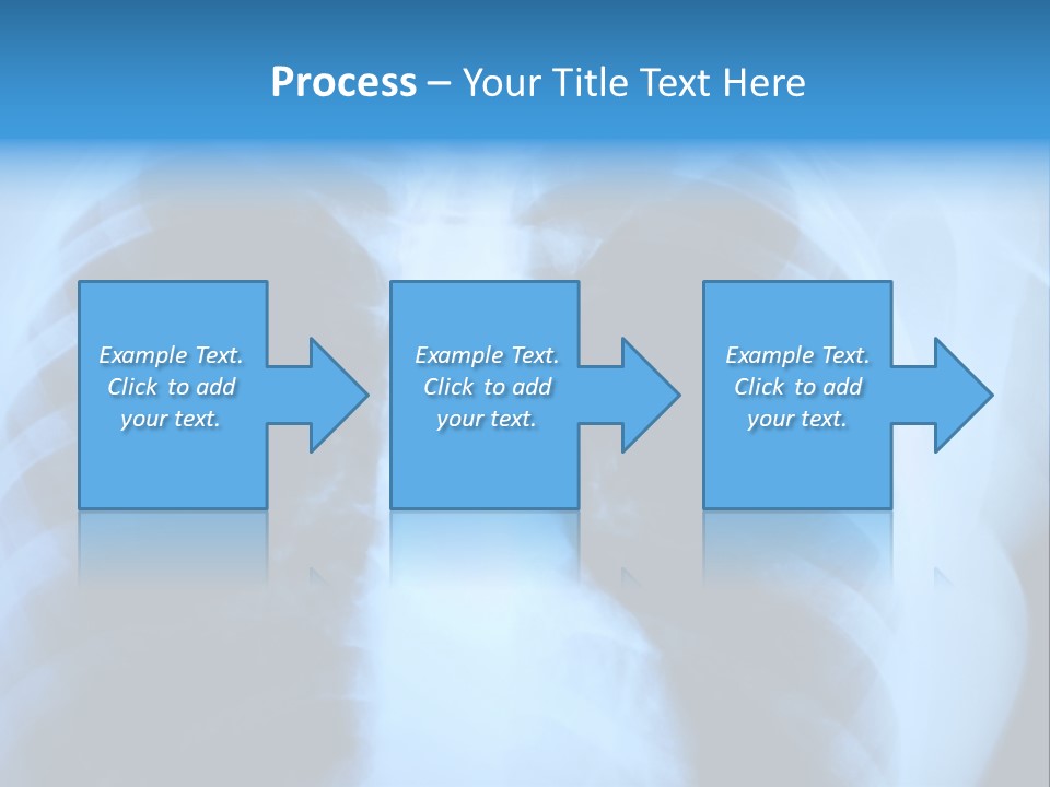 A Radiograph Of Human Body Is In Black And White Tones PowerPoint Template
