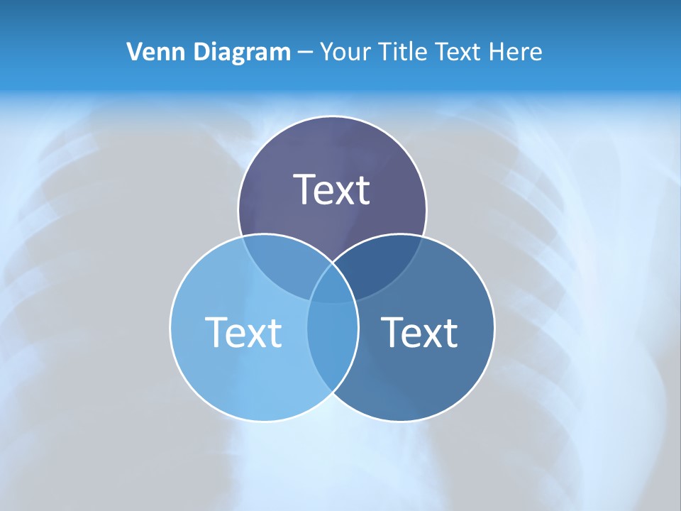 A Radiograph Of Human Body Is In Black And White Tones PowerPoint Template
