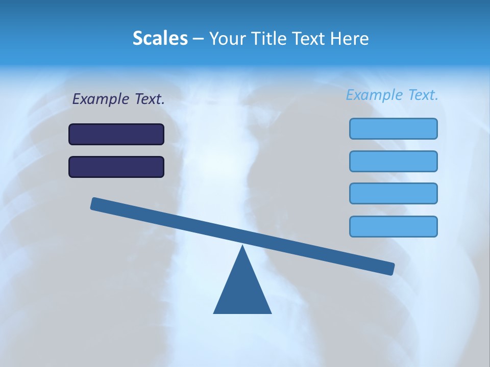 A Radiograph Of Human Body Is In Black And White Tones PowerPoint Template