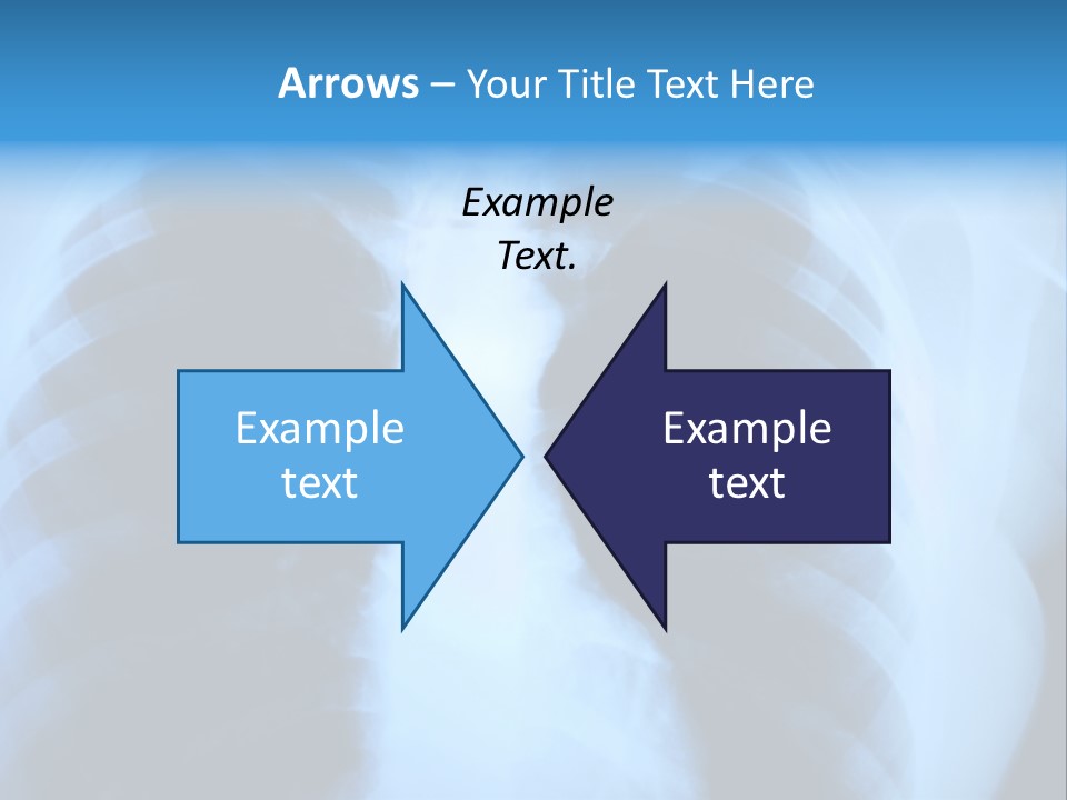 A Radiograph Of Human Body Is In Black And White Tones PowerPoint Template