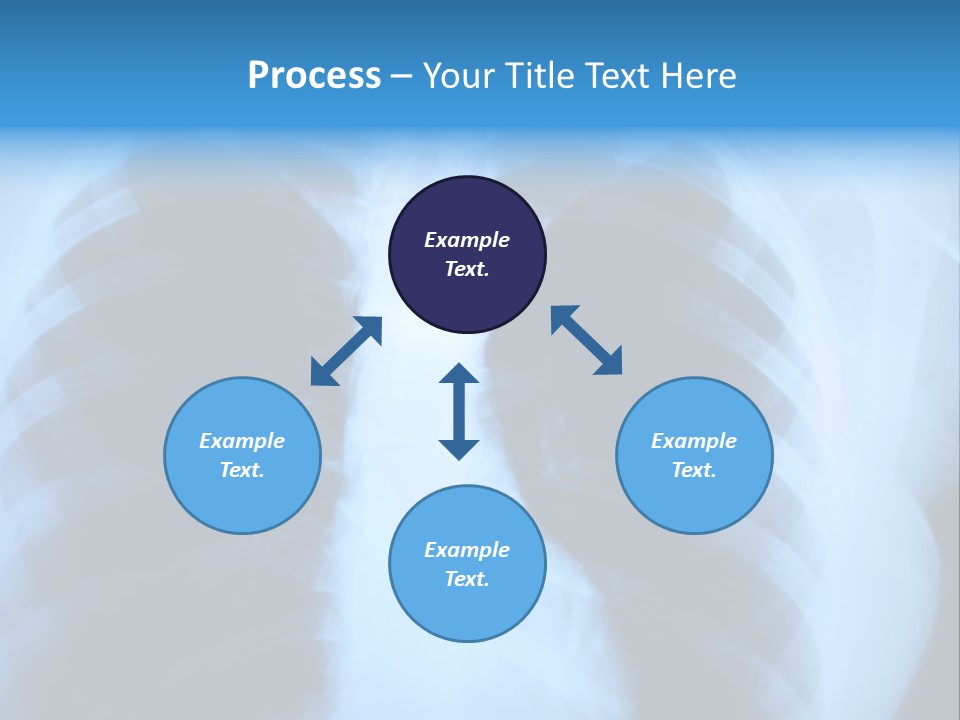 A Radiograph Of Human Body Is In Black And White Tones PowerPoint Template