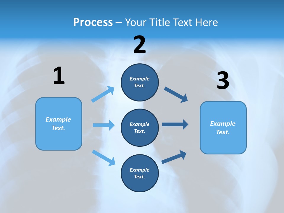 A Radiograph Of Human Body Is In Black And White Tones PowerPoint Template