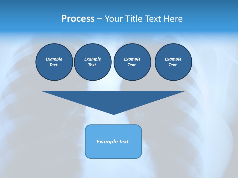 A Radiograph Of Human Body Is In Black And White Tones PowerPoint Template
