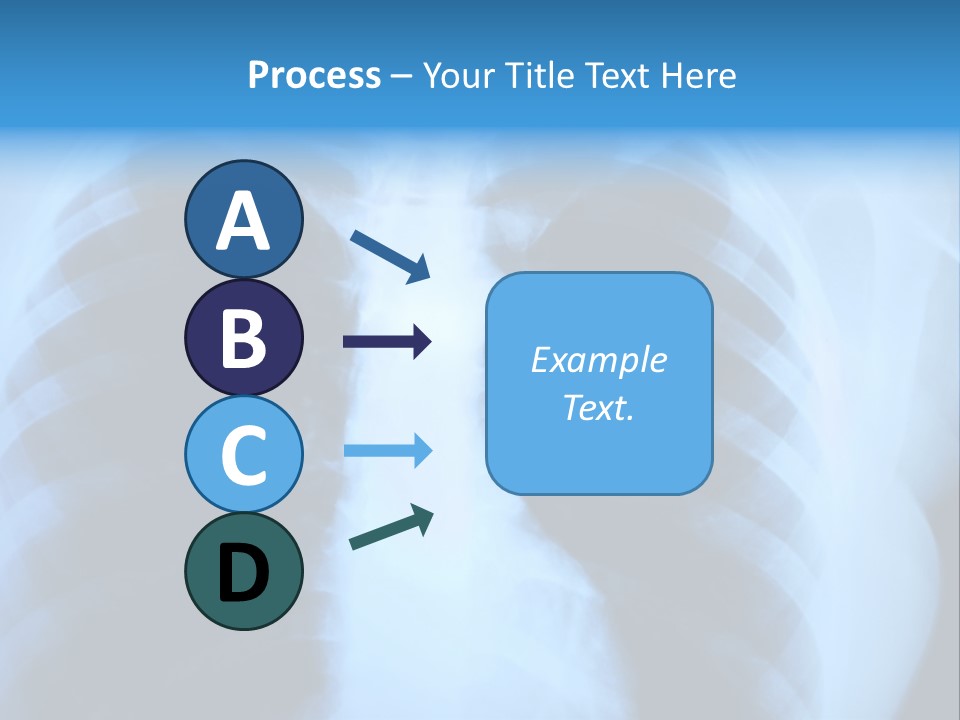 A Radiograph Of Human Body Is In Black And White Tones PowerPoint Template