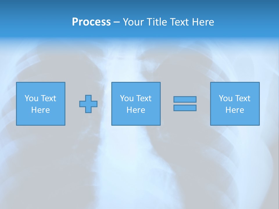 A Radiograph Of Human Body Is In Black And White Tones PowerPoint Template