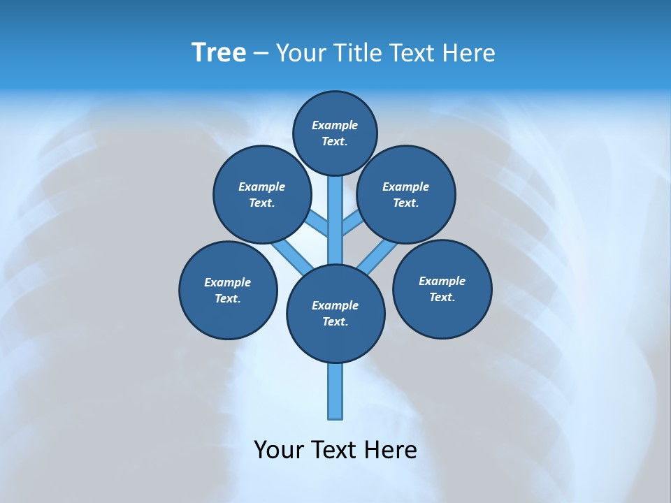 A Radiograph Of Human Body Is In Black And White Tones PowerPoint Template