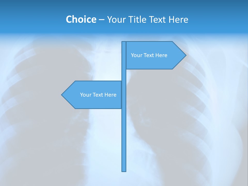 A Radiograph Of Human Body Is In Black And White Tones PowerPoint Template