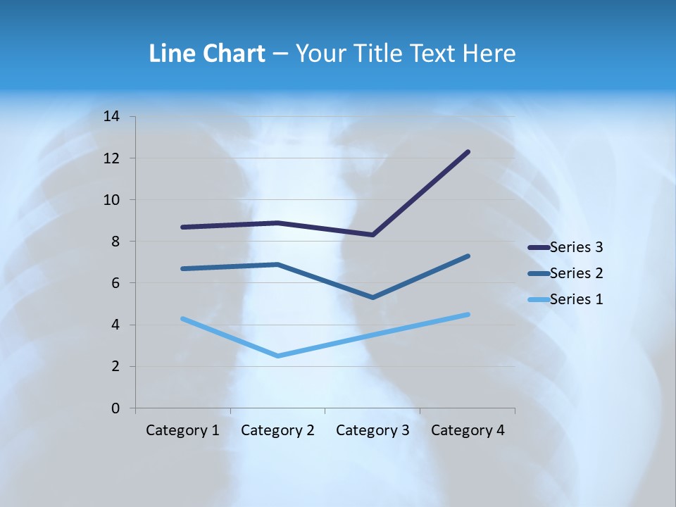 A Radiograph Of Human Body Is In Black And White Tones PowerPoint Template