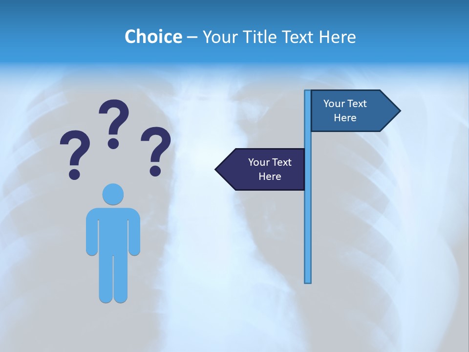 A Radiograph Of Human Body Is In Black And White Tones PowerPoint Template