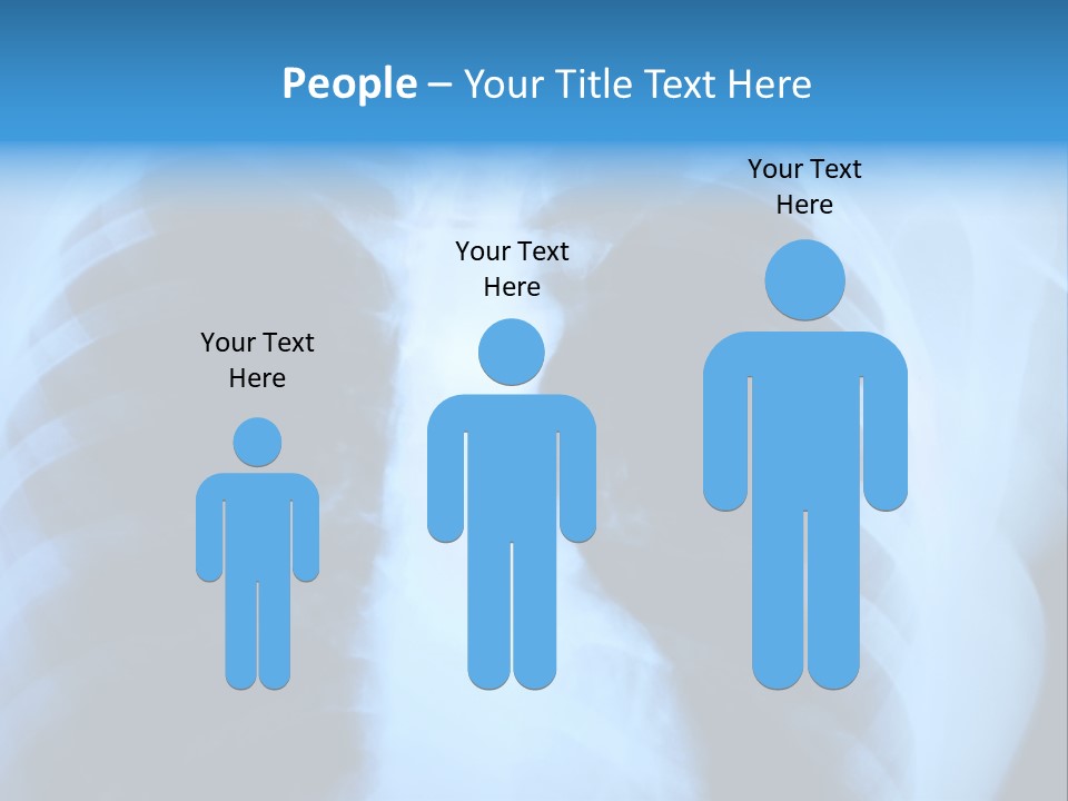 A Radiograph Of Human Body Is In Black And White Tones PowerPoint Template