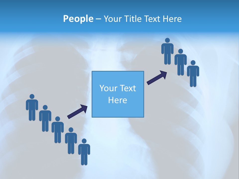 A Radiograph Of Human Body Is In Black And White Tones PowerPoint Template