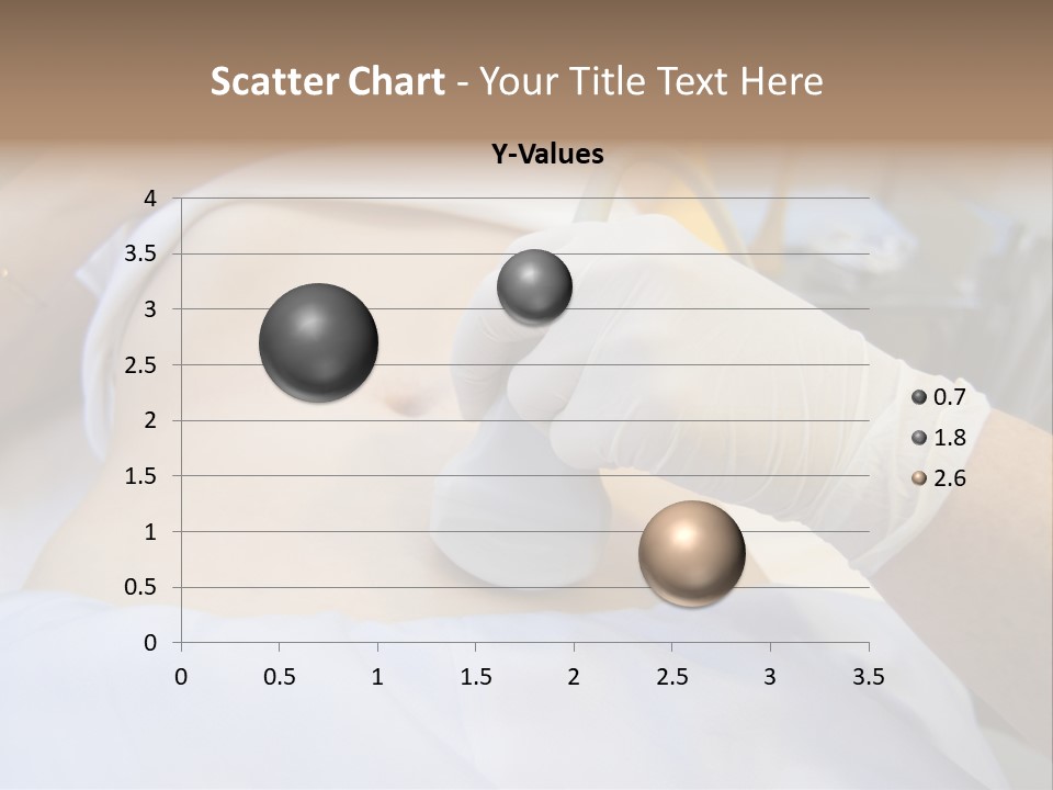 Scanning Of A Stomach Of Pregnant Woman PowerPoint Template