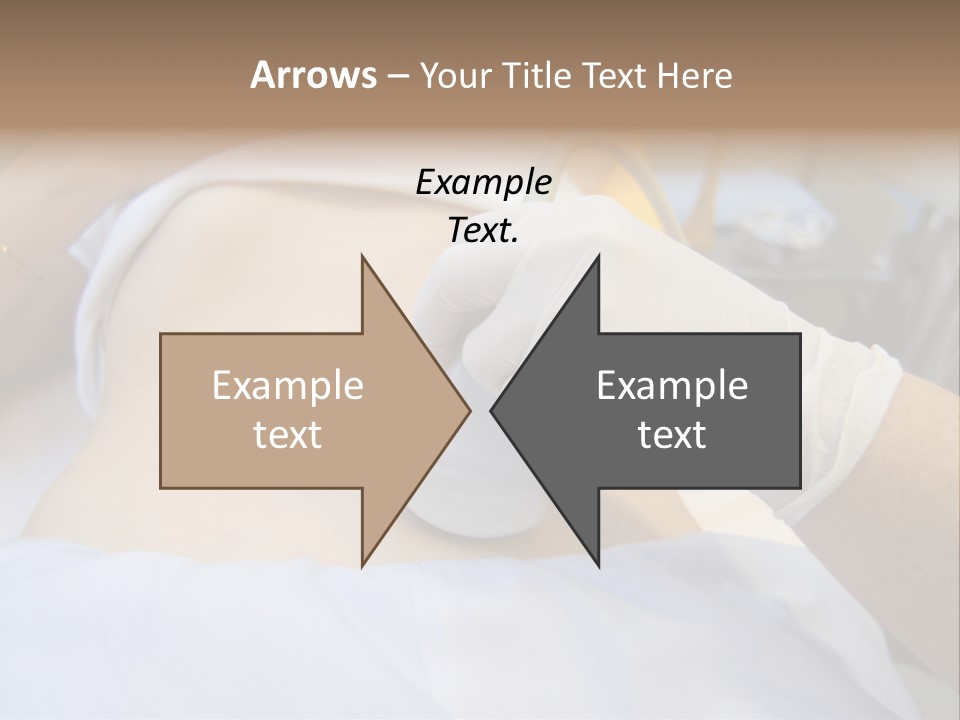 Scanning Of A Stomach Of Pregnant Woman PowerPoint Template