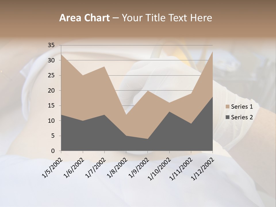 Scanning Of A Stomach Of Pregnant Woman PowerPoint Template