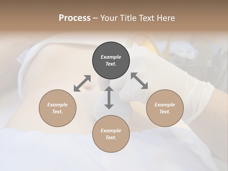 Scanning Of A Stomach Of Pregnant Woman PowerPoint Template