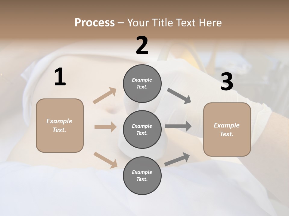Scanning Of A Stomach Of Pregnant Woman PowerPoint Template