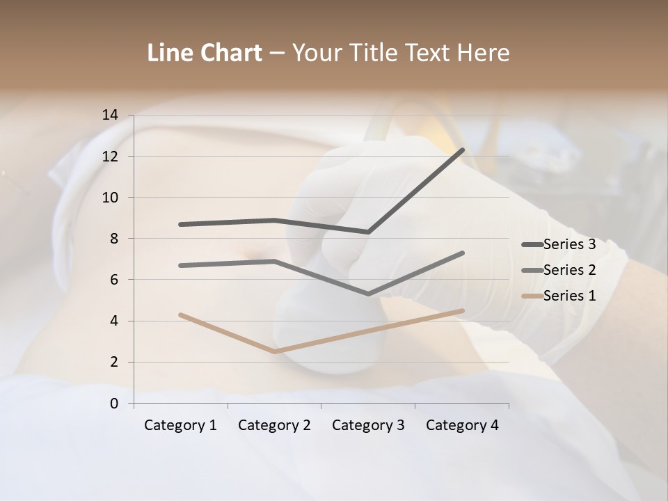 Scanning Of A Stomach Of Pregnant Woman PowerPoint Template