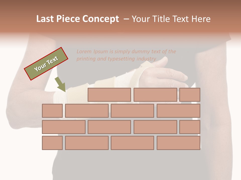 Close Up Of Woman's Arm In Splint PowerPoint Template