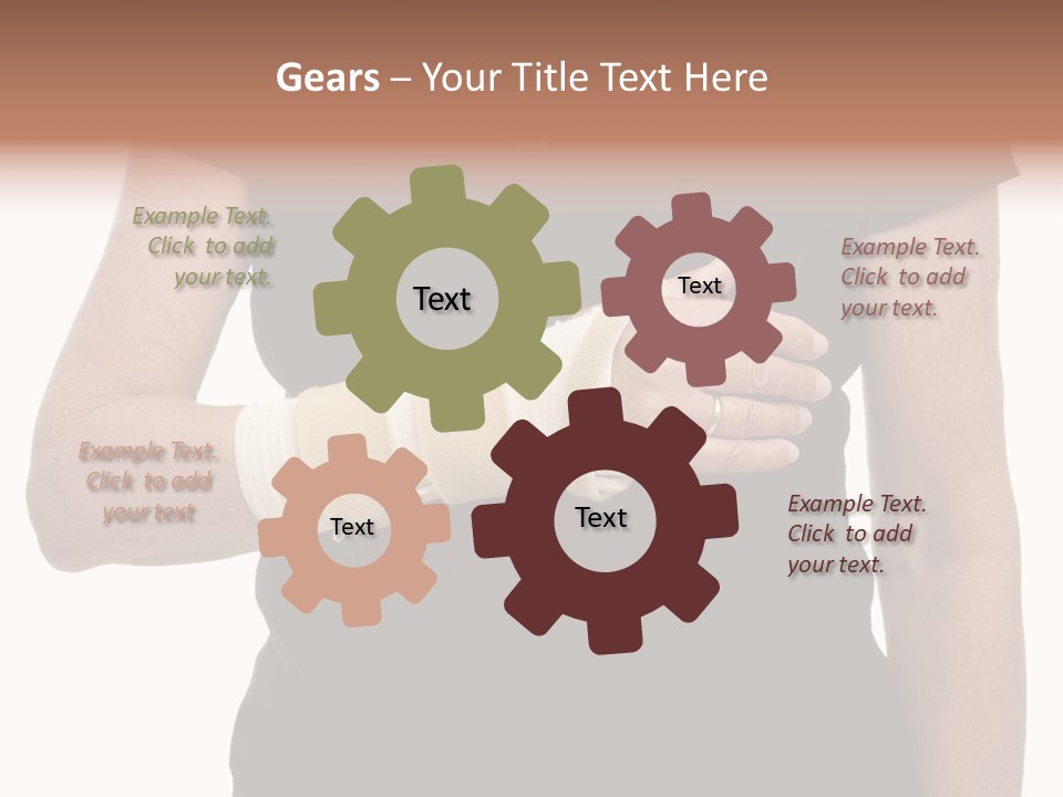 Close Up Of Woman's Arm In Splint PowerPoint Template