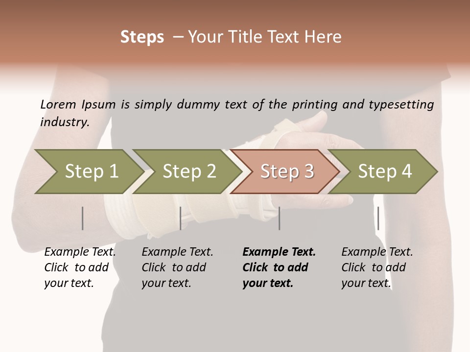 Close Up Of Woman's Arm In Splint PowerPoint Template