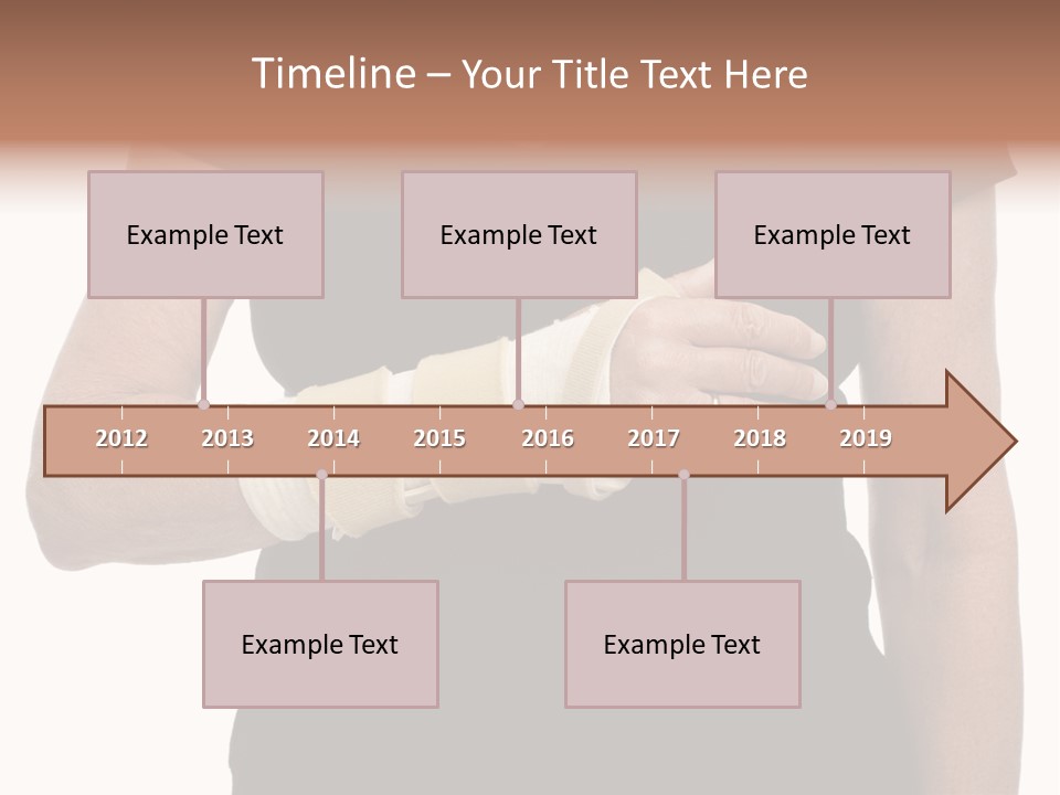 Close Up Of Woman's Arm In Splint PowerPoint Template