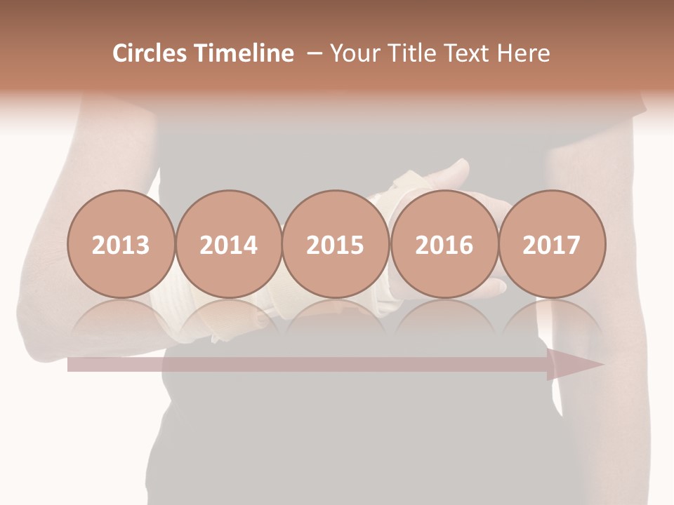 Close Up Of Woman's Arm In Splint PowerPoint Template