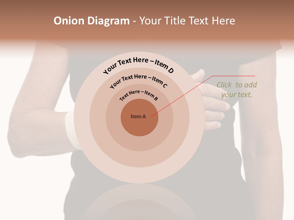 Close Up Of Woman's Arm In Splint PowerPoint Template
