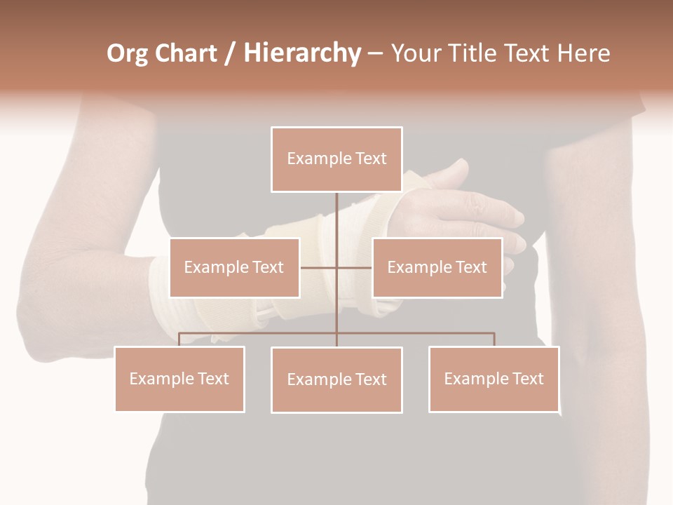 Close Up Of Woman's Arm In Splint PowerPoint Template
