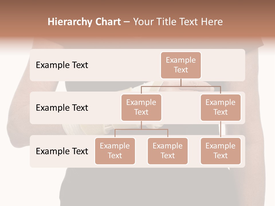 Close Up Of Woman's Arm In Splint PowerPoint Template