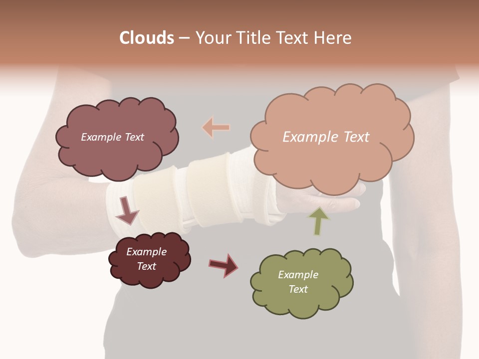 Close Up Of Woman's Arm In Splint PowerPoint Template