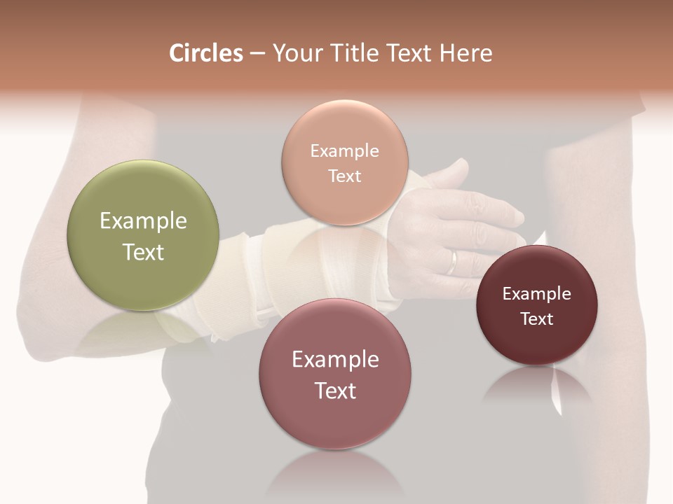 Close Up Of Woman's Arm In Splint PowerPoint Template