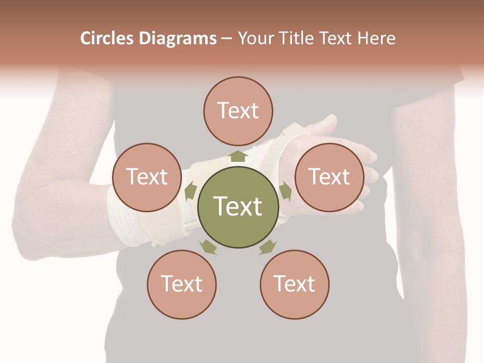 Close Up Of Woman's Arm In Splint PowerPoint Template