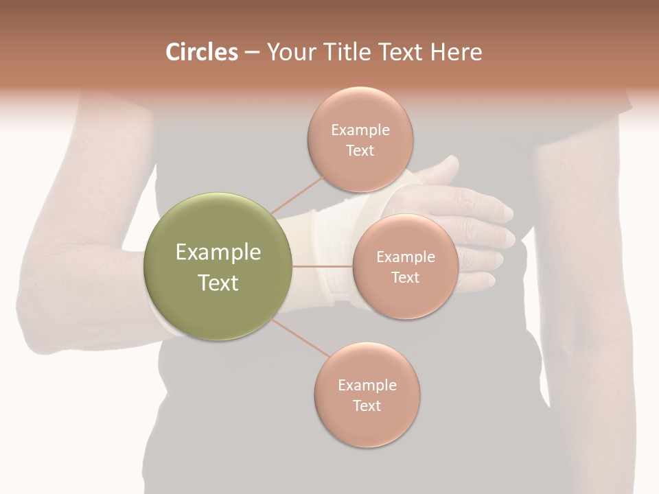 Close Up Of Woman's Arm In Splint PowerPoint Template
