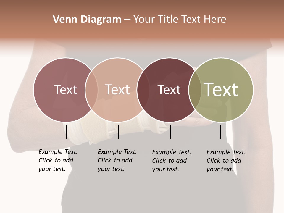 Close Up Of Woman's Arm In Splint PowerPoint Template