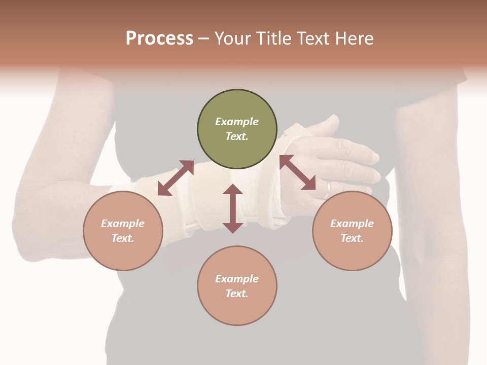 Close Up Of Woman's Arm In Splint PowerPoint Template