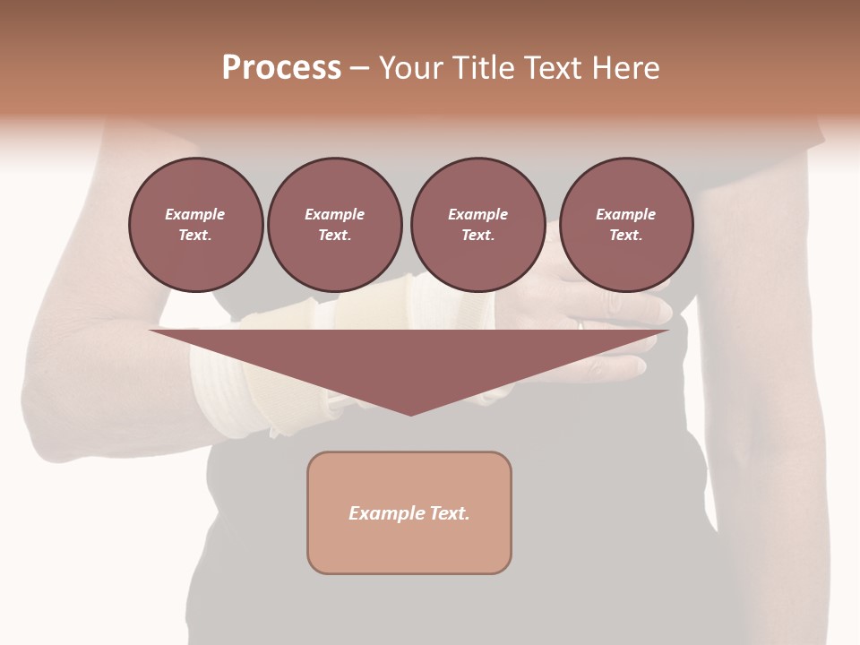 Close Up Of Woman's Arm In Splint PowerPoint Template
