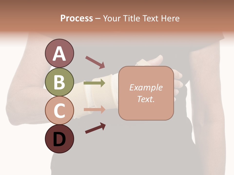 Close Up Of Woman's Arm In Splint PowerPoint Template