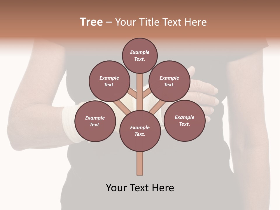 Close Up Of Woman's Arm In Splint PowerPoint Template