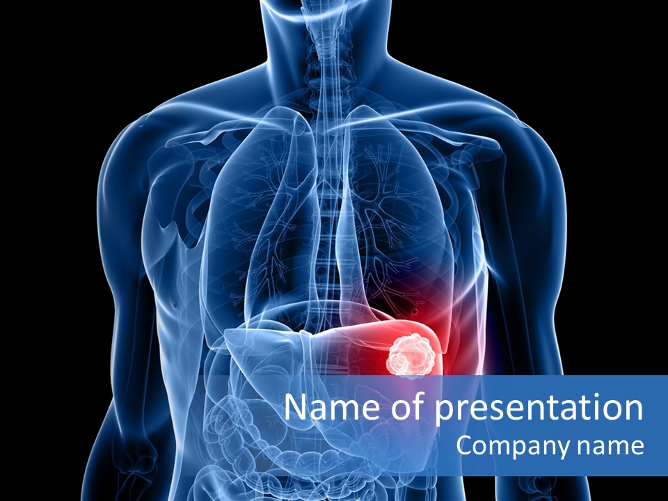 Tumor Cancer Medical PowerPoint Template