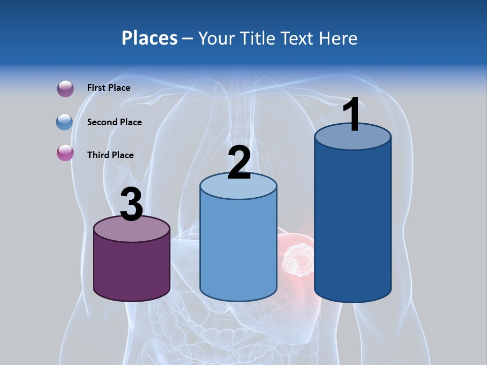 Tumor Cancer Medical PowerPoint Template
