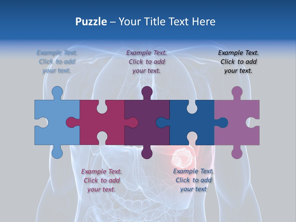 Tumor Cancer Medical PowerPoint Template