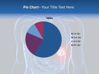 Tumor Cancer Medical PowerPoint Template