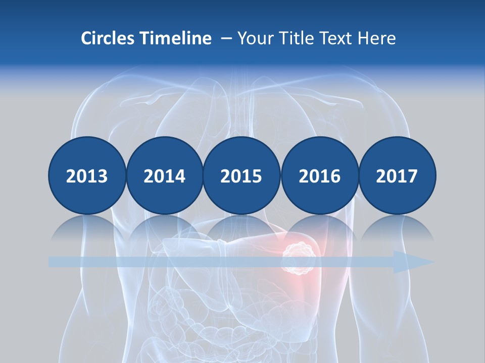 Tumor Cancer Medical PowerPoint Template