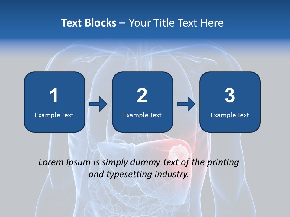 Tumor Cancer Medical PowerPoint Template