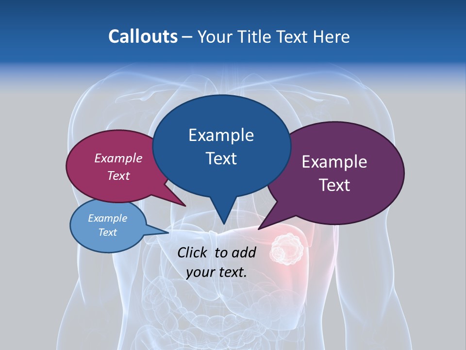 Tumor Cancer Medical PowerPoint Template